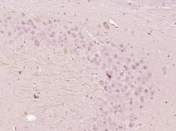 OSBPL5 Polyclonal Antibody
