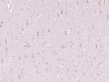 OSBPL11 Polyclonal Antibody