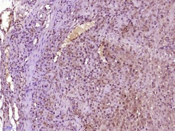 SHOX2 Polyclonal Antibody