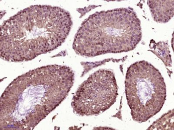 SCNM1 Polyclonal Antibody