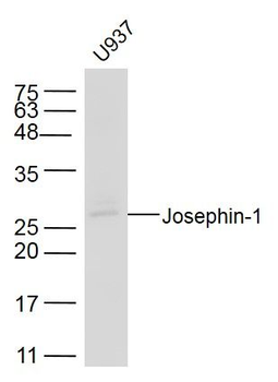 Josephin-1 Polyclonal Antibody
