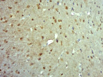 TRMT1 Polyclonal Antibody