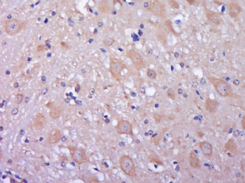 KIAA0556 Polyclonal Antibody
