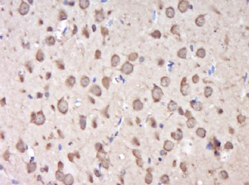 KIAA0319L Polyclonal Antibody