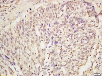 KDM5A Polyclonal Antibody