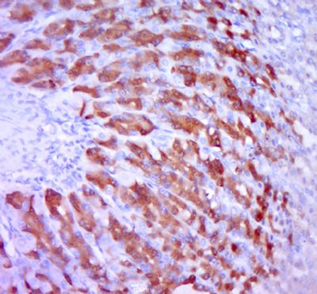 KLC3 Polyclonal Antibody