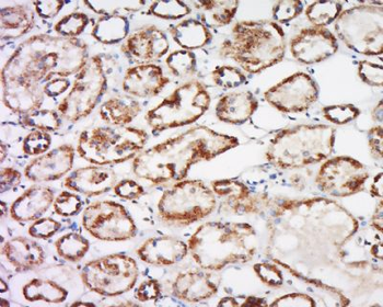 Trehalase Polyclonal Antibody