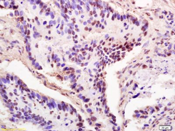 THOC2 Polyclonal Antibody