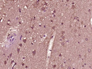 ZNF683 Polyclonal Antibody