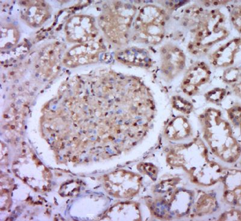 ZNF804B Polyclonal Antibody