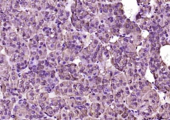 IFT140 Polyclonal Antibody