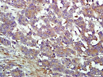 IFIT1B Polyclonal Antibody