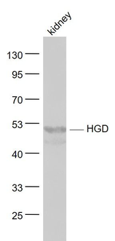 HGD Polyclonal Antibody