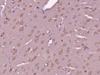 GPR89A Polyclonal Antibody