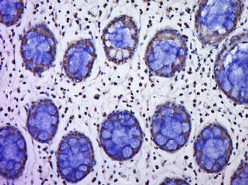 C9orf96 Polyclonal Antibody