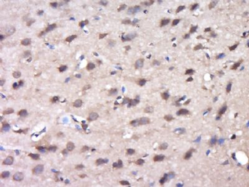 C9orf41 Polyclonal Antibody