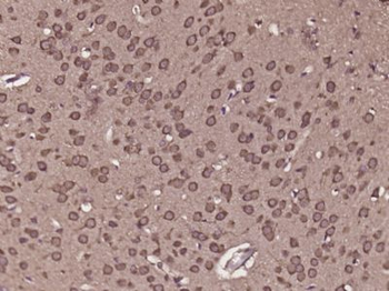 C8orf84 Polyclonal Antibody
