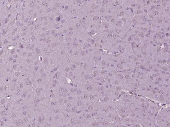C7orf59 Polyclonal Antibody