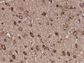 C6orf206 Polyclonal Antibody