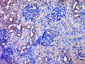 C20orf96 Polyclonal Antibody