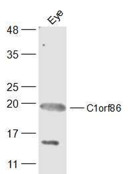 C1orf86 Polyclonal Antibody