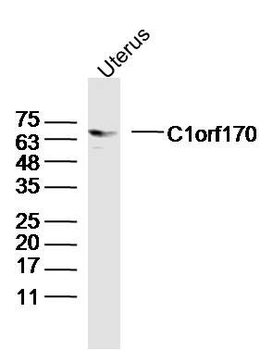 C1orf170 Polyclonal Antibody