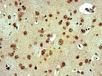 FAM193B Polyclonal Antibody