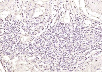 Exportin T Polyclonal Antibody