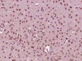 EXOSC4 Polyclonal Antibody