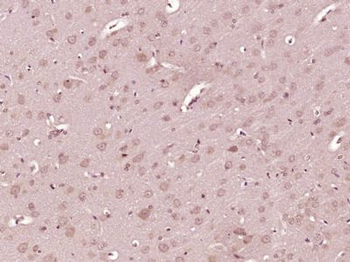 EXOC6 Polyclonal Antibody