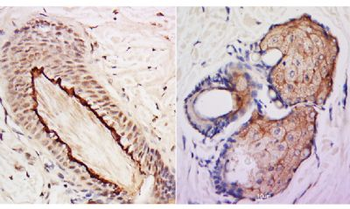 SHFM1/DSS1 Polyclonal Antibody
