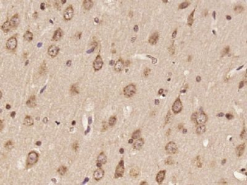 DNAH6 Polyclonal Antibody