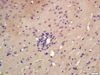 DNA Polymerase epsilon Polyclonal Antibody