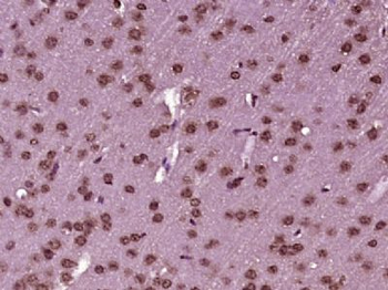 DHX33 Polyclonal Antibody