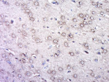 DGKG Polyclonal Antibody