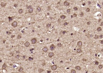 DDX60 Polyclonal Antibody