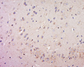 CORO2B Polyclonal Antibody