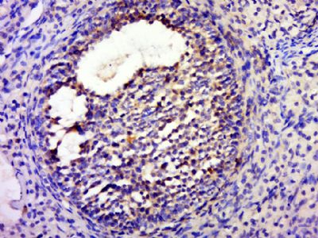 FTS Polyclonal Antibody