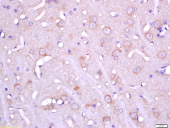 FHOD3 Polyclonal Antibody