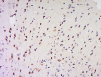 EXOSC7 Polyclonal Antibody
