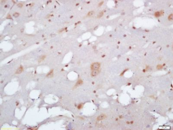EXOC2 Polyclonal Antibody