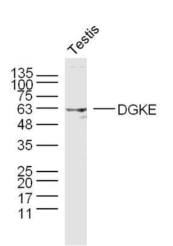 DGKE Polyclonal Antibody