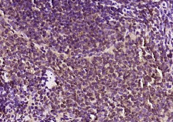 DAPP1 Polyclonal Antibody