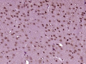ZNF182 Polyclonal Antibody