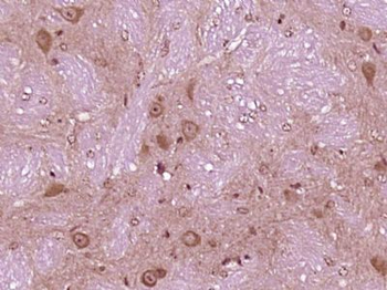 VPS29 Polyclonal Antibody