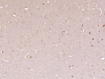 PLCD1/NDNC3 Polyclonal Antibody