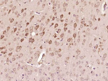 SMCR7 Polyclonal Antibody