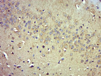 PDE9A Polyclonal Antibody