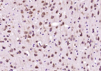 ARF5 Polyclonal Antibody