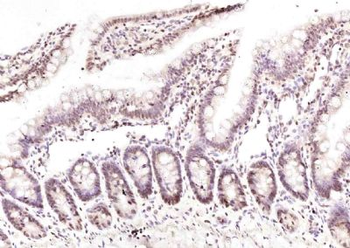 TCTN1 Polyclonal Antibody